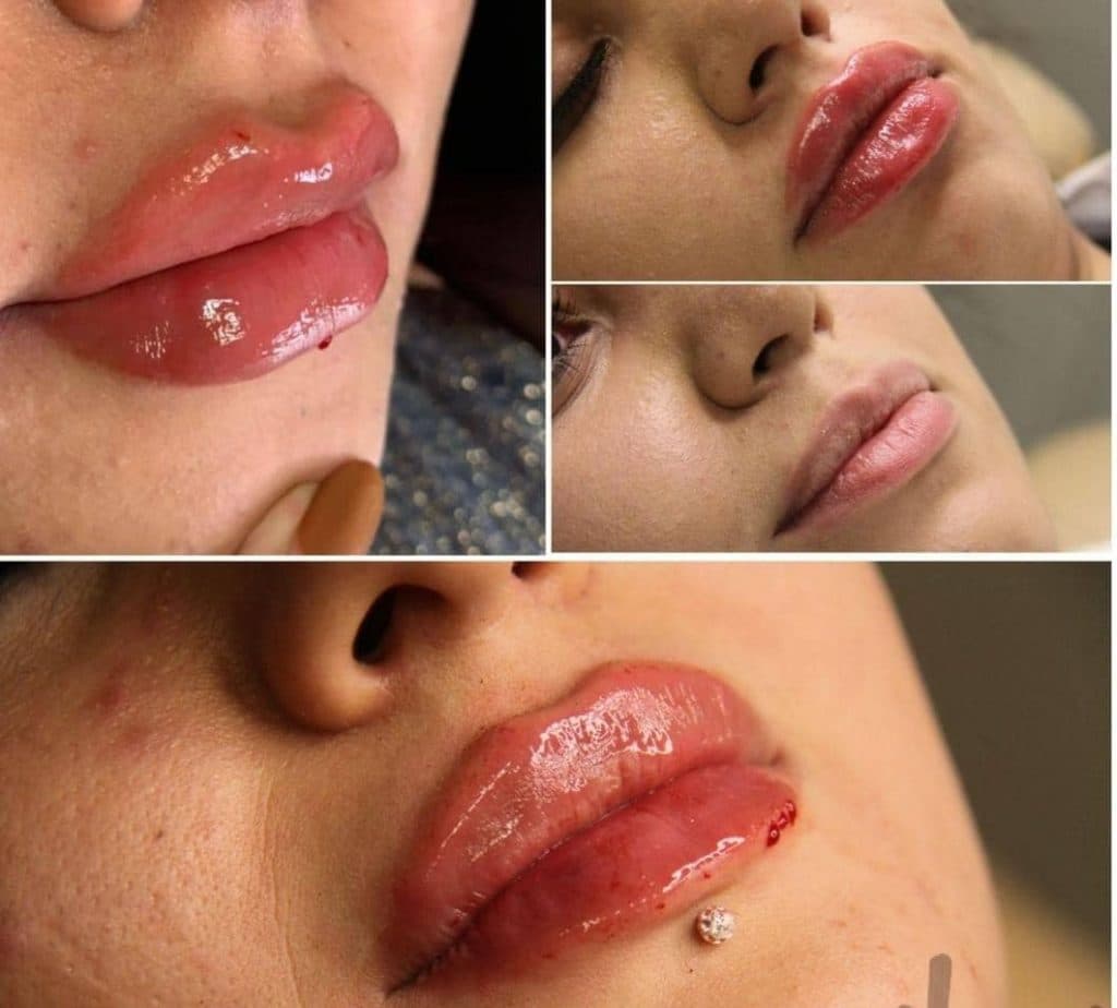 مطب زیبایی میری در تبریز