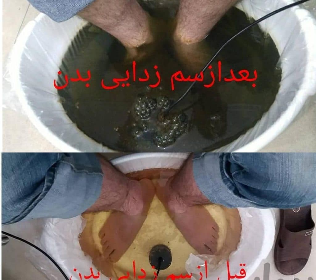 مطب زیبایی میری در تبریز