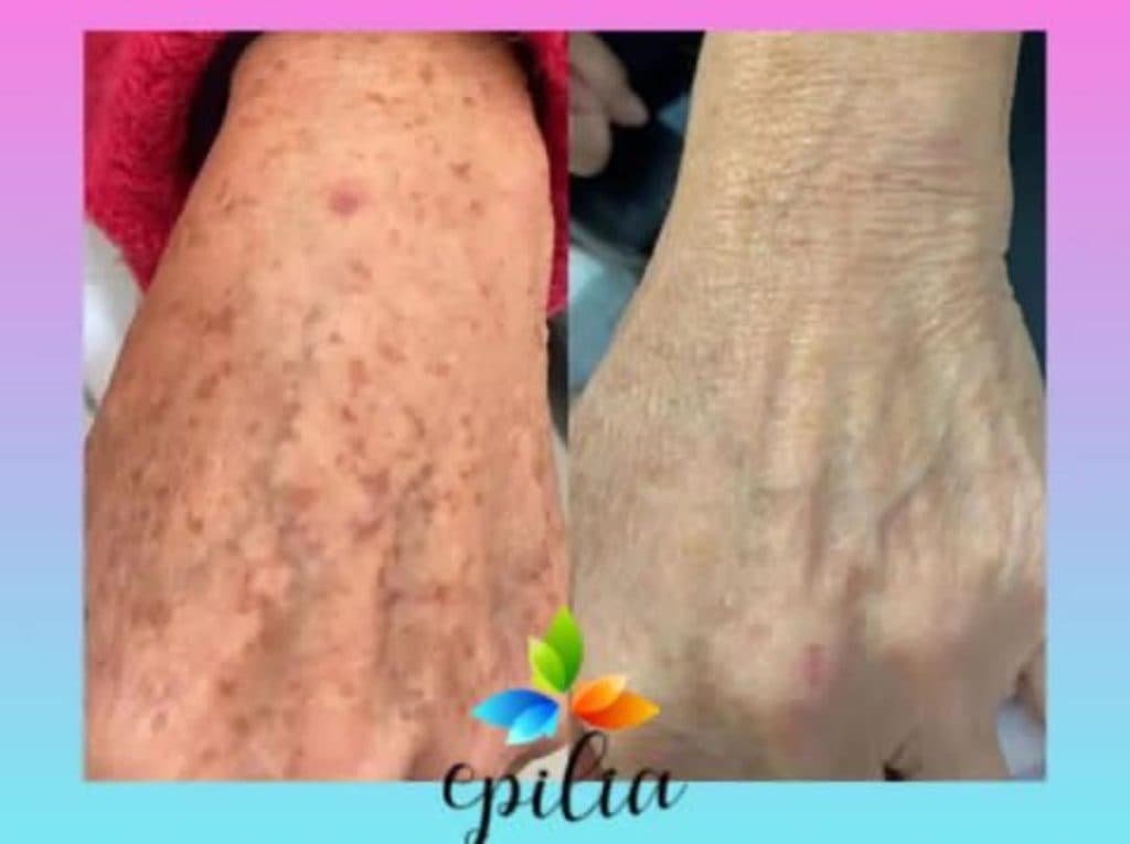 خدمات زیبایی اندولیفت و هایفو و بوتاکس مرکز زیبایی دکتر رحیمی در اصفهان