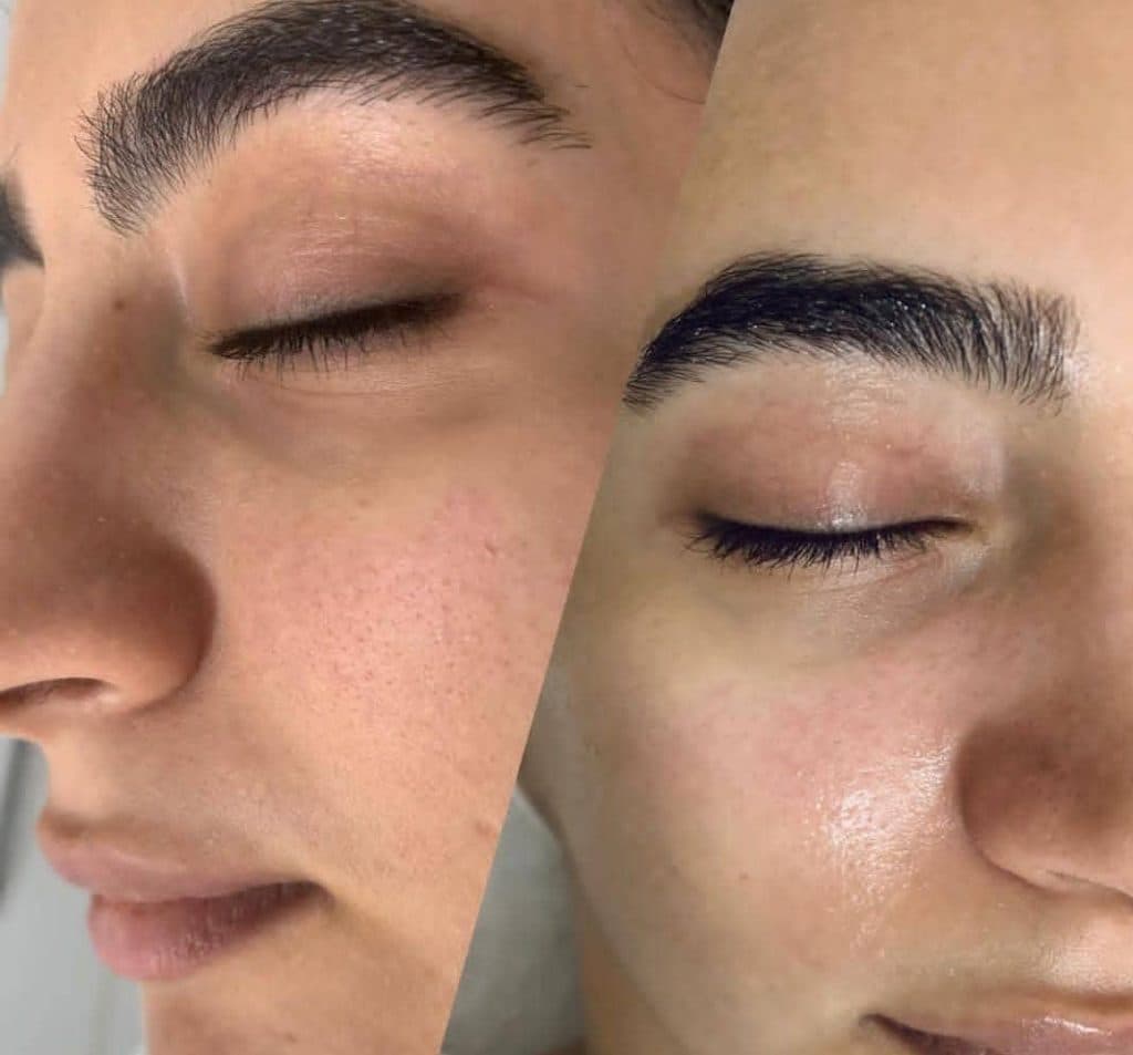 خدمات زیبایی و فیشیال پوست و مو صفیه شیبانی در قشم