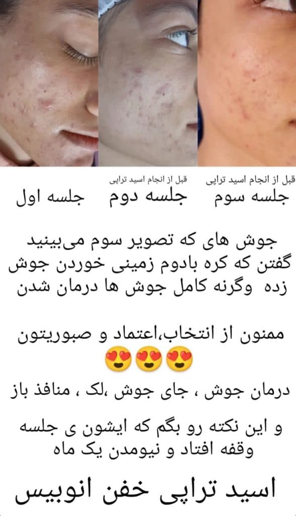 آموزش و خدمات فشیال تخصصی و پاکسازی پوست ساجده افضلی در مشهد