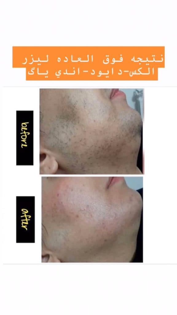 مرکز و کلینیک زیبایی بیتا در ساری