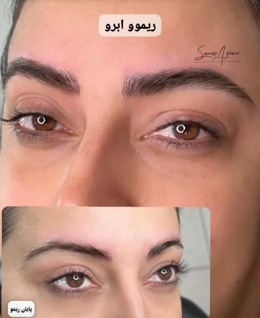 آموزش تخصصی آرایش دائم میکروبلیدینگ ابرو و ریموو تاتو ساناز عظیمی در آمل