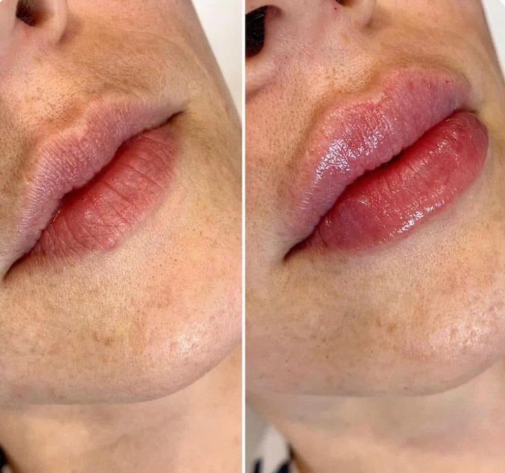 مرکز و کلینیک زیبایی بیتا در ساری