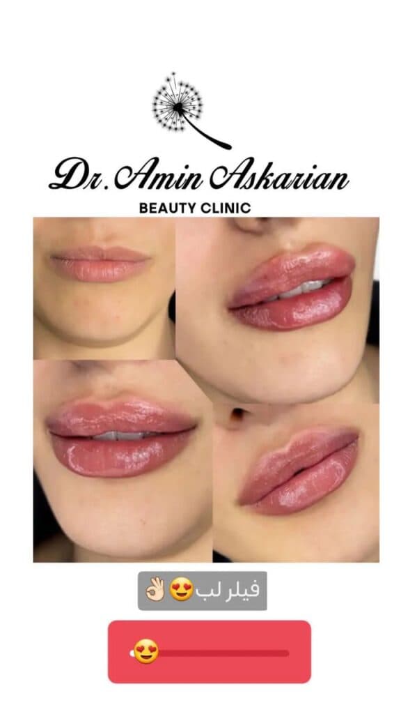 کلینیک زیبایی پوست مو و لیزر دکتر امین عسکریان در شیراز