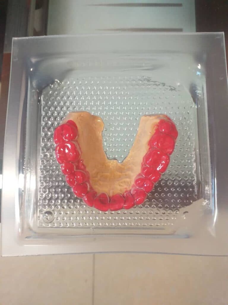 ساخت ترمیم و تعمیر دندان مصنوعی در منزل دندانسازی دریا در ونک تهران