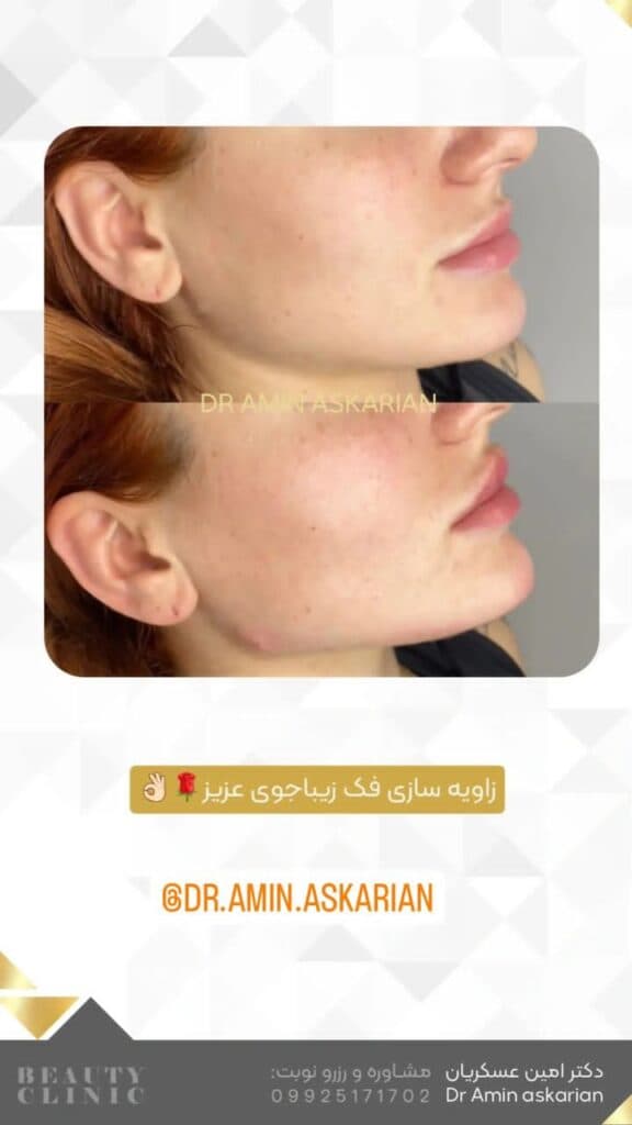 کلینیک زیبایی پوست مو و لیزر دکتر امین عسکریان در شیراز