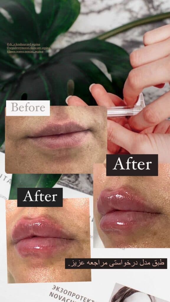 مرکز زیبایی پوست و مو سپینا در ارومیه