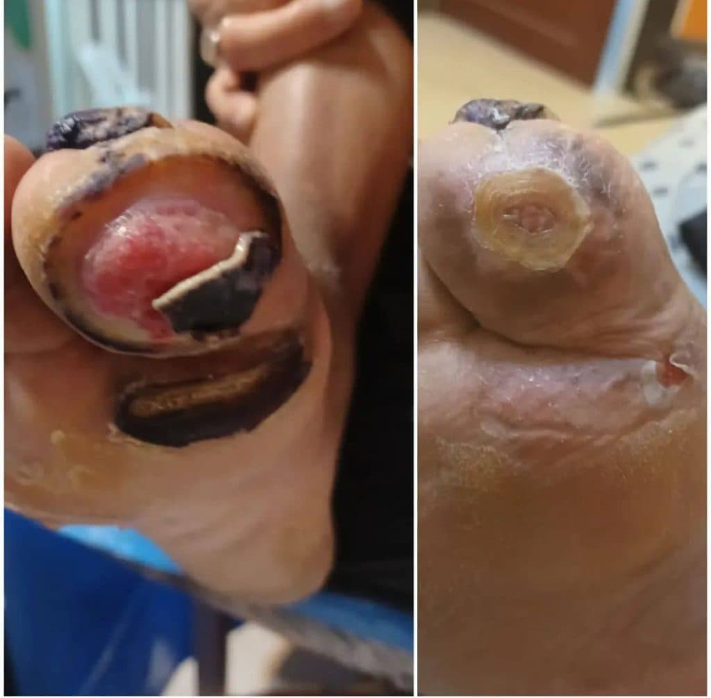 کلینیک و مرکز تخصصی درمان زخم و ترمیم بافت مرهم در ماهشهر