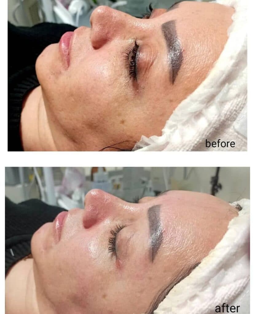 مرکز زیبایی پوست و مو سپینا در ارومیه