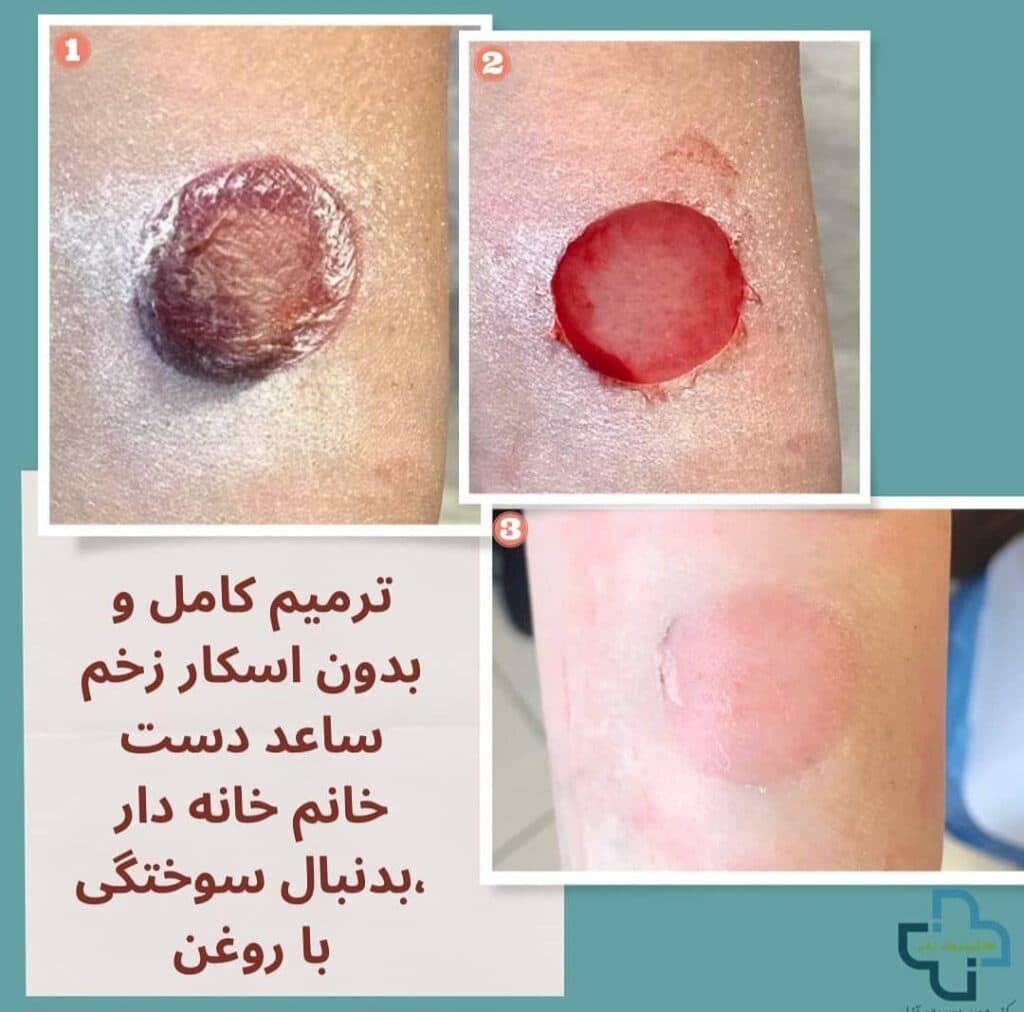 کلینیک تخصصی درمان زخم و ترمیم بافت دکتر موسوی آزاد در رشت گیلان
