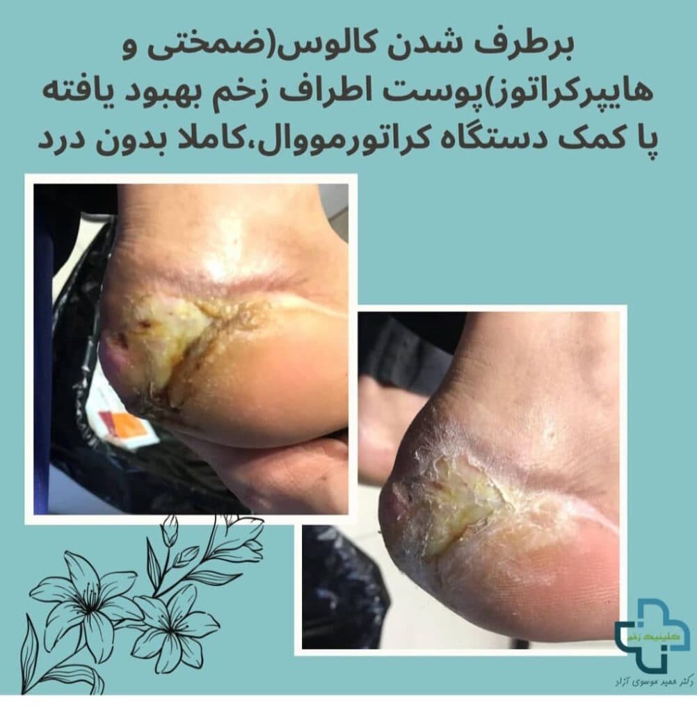 کلینیک تخصصی درمان زخم و ترمیم بافت دکتر موسوی آزاد در رشت گیلان