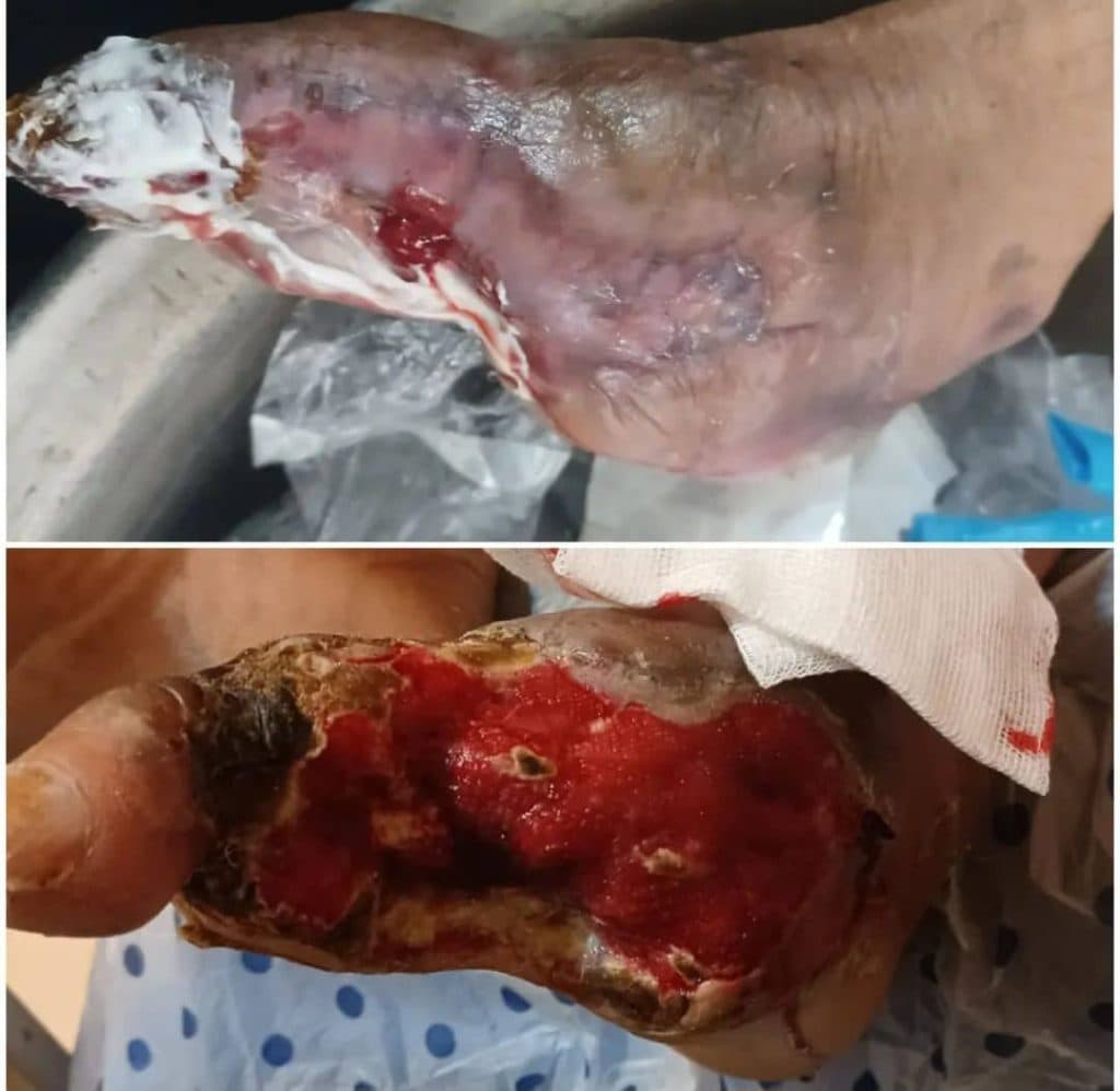 کلینیک و مرکز تخصصی درمان زخم و ترمیم بافت مرهم در ماهشهر