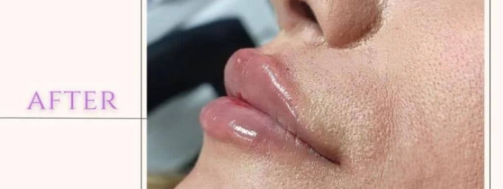 کلینیک تخصصی زیبایی لیفت نخ و طب سوزنی نبضی نو در تهران