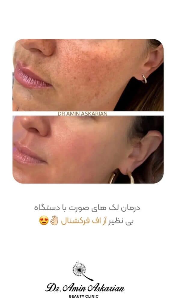 کلینیک زیبایی پوست مو و لیزر دکتر امین عسکریان در شیراز