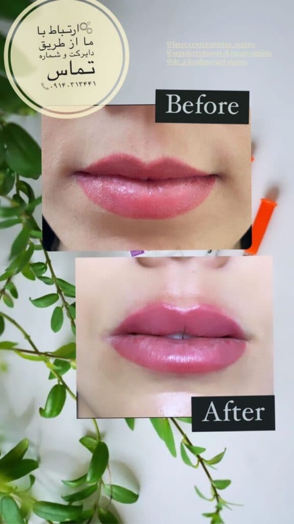 مرکز زیبایی پوست و مو سپینا در ارومیه