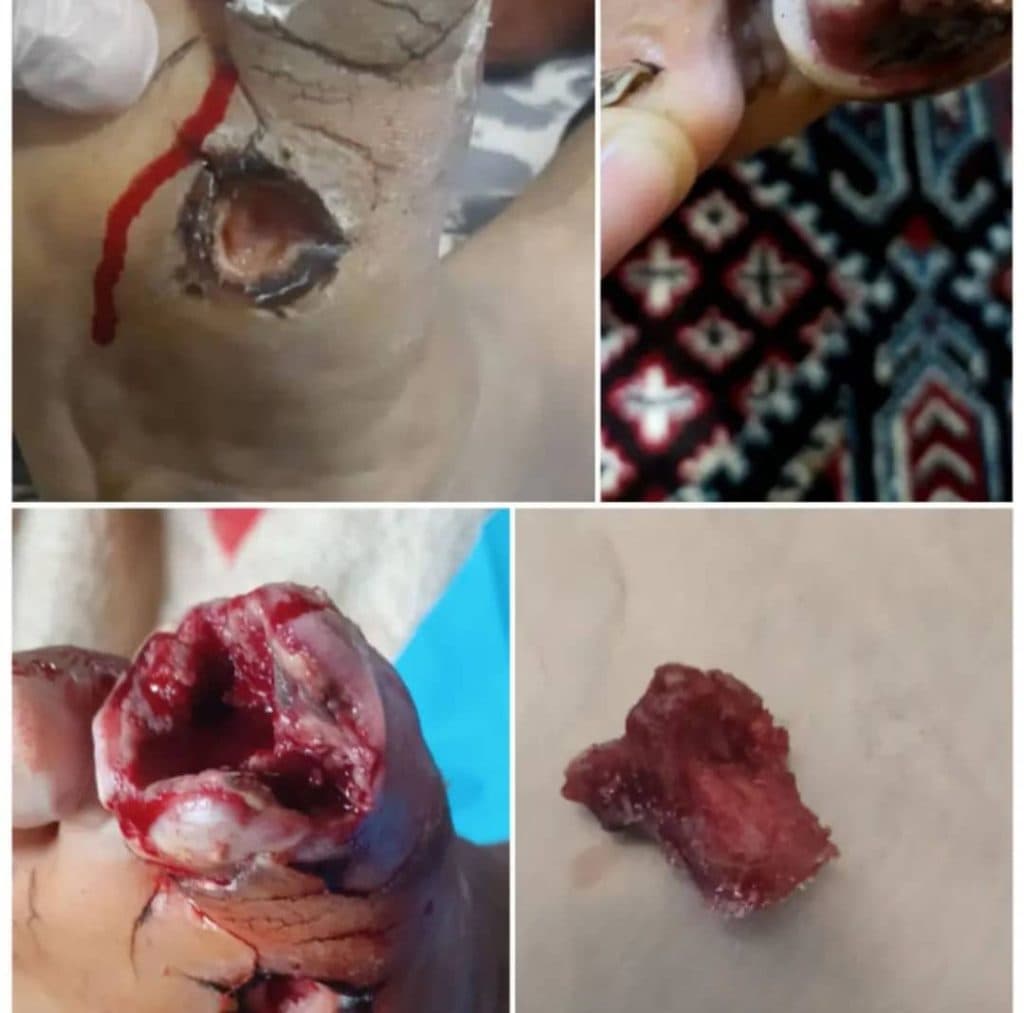 کلینیک و مرکز تخصصی درمان زخم و ترمیم بافت مرهم در ماهشهر