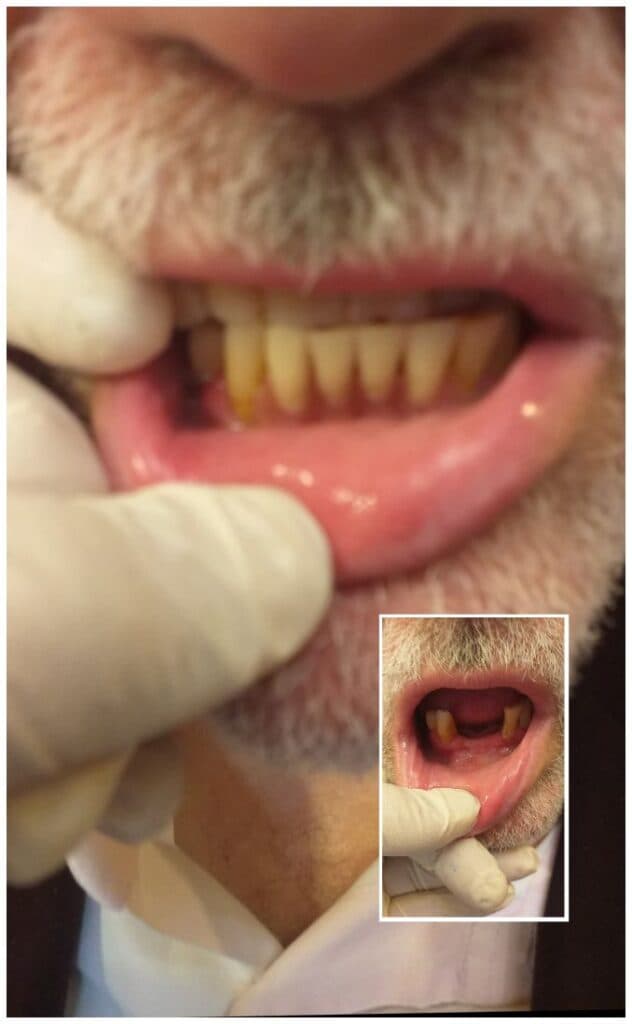 لابراتوار ساخت قالبگیری دندان مصنوعی دندانسازی سیار دریا در فرحزاد تهران