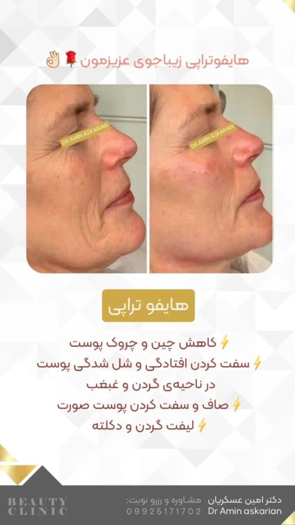 کلینیک زیبایی پوست مو و لیزر دکتر امین عسکریان در شیراز