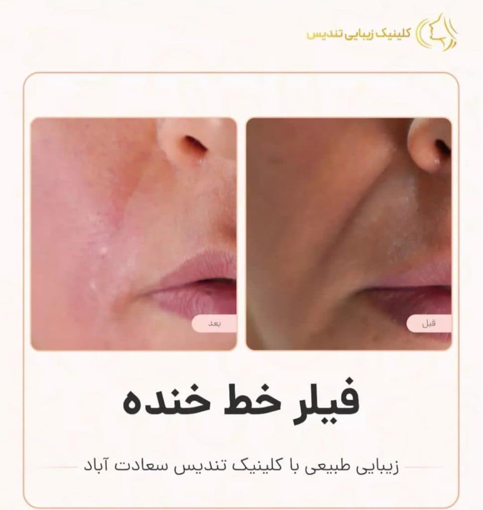 کلینیک زیبایی تندیس در سعادت آباد تهران