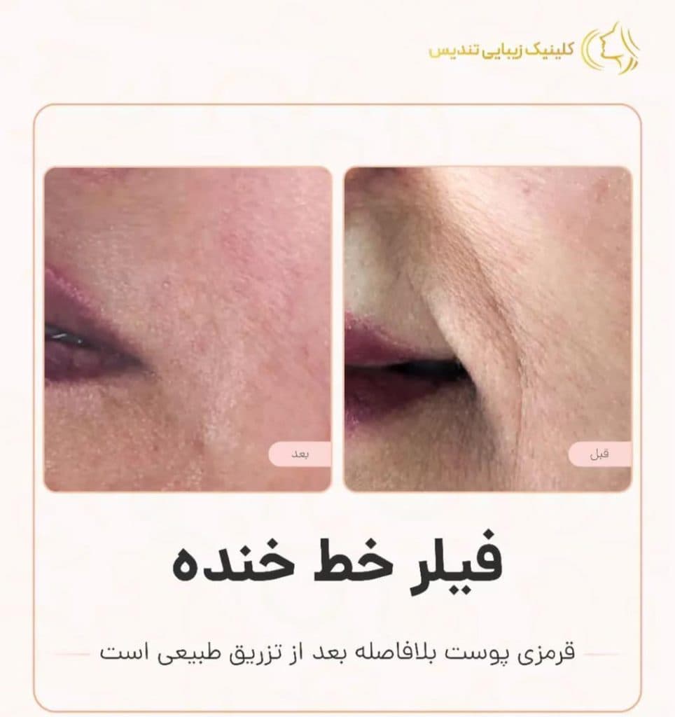 کلینیک زیبایی تندیس در سعادت آباد تهران