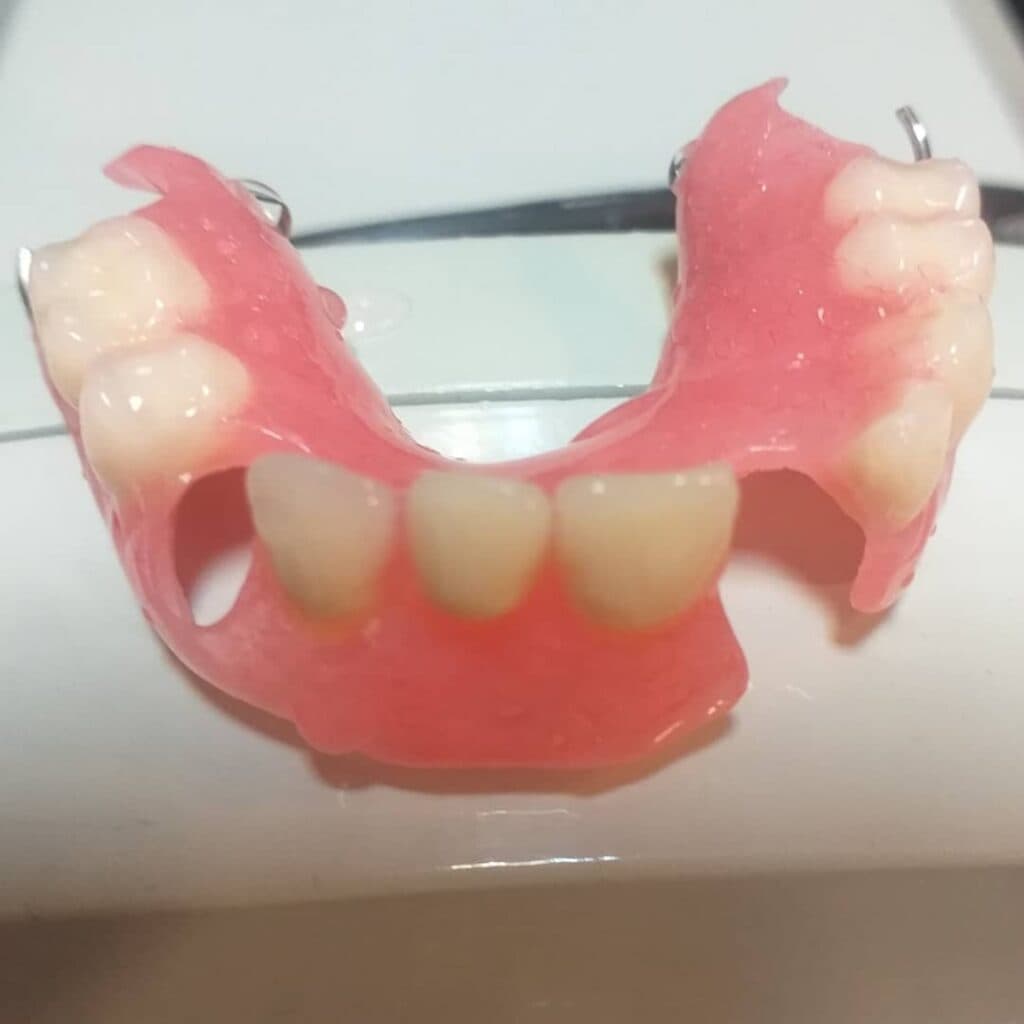 ساخت دست دندان کامل فول دنچر دندانسازی دریا در جنت آباد تهران