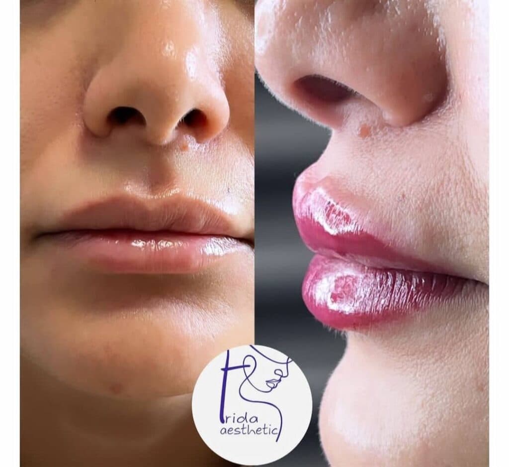 کلینیک پوست مو لیزر زیبایی دکتر فریدا شاه نعمت الهی در تهران