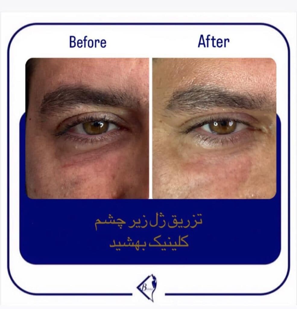 مرکز لیزر و کلینیک زیبایی بهشید در اراک