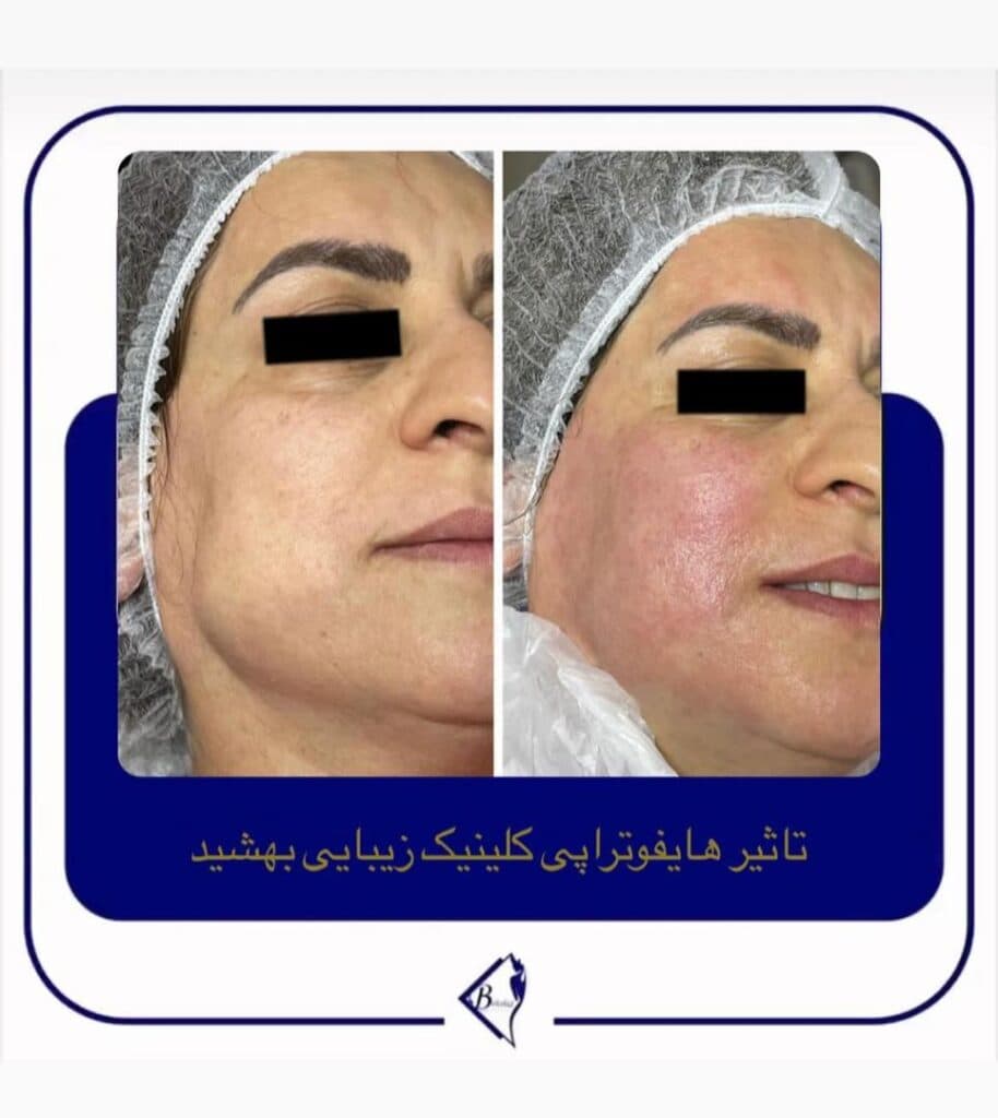 مرکز لیزر و کلینیک زیبایی بهشید در اراک