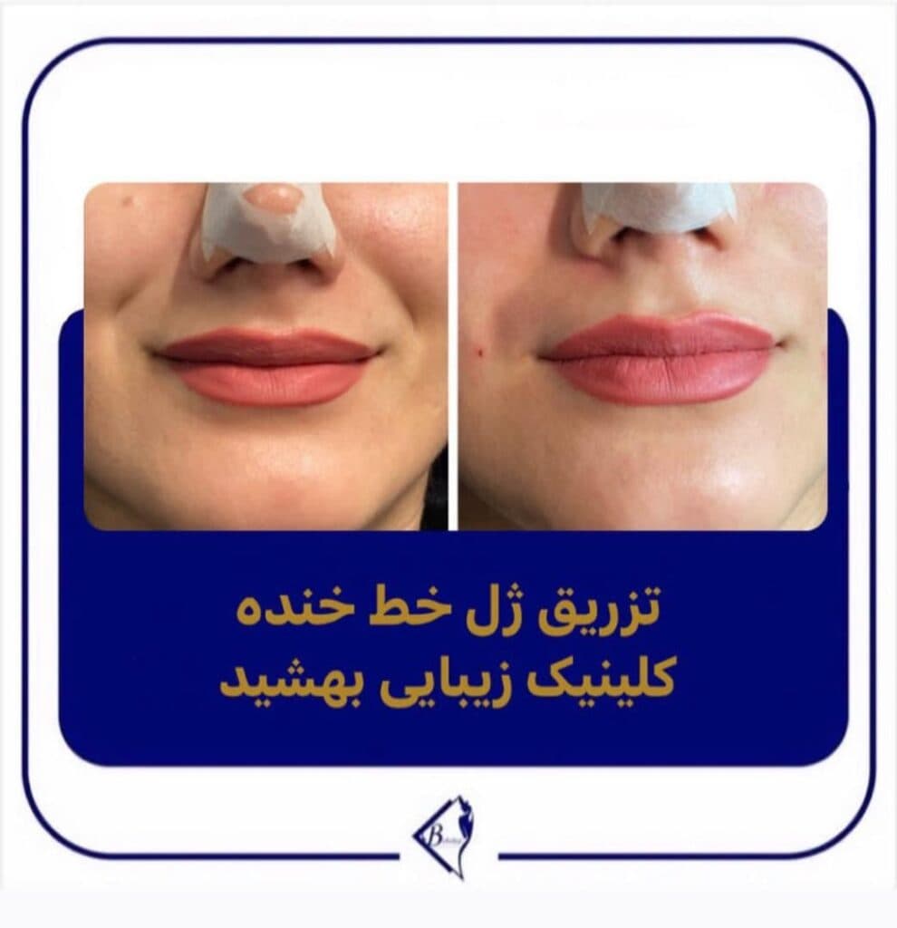مرکز لیزر و کلینیک زیبایی بهشید در اراک