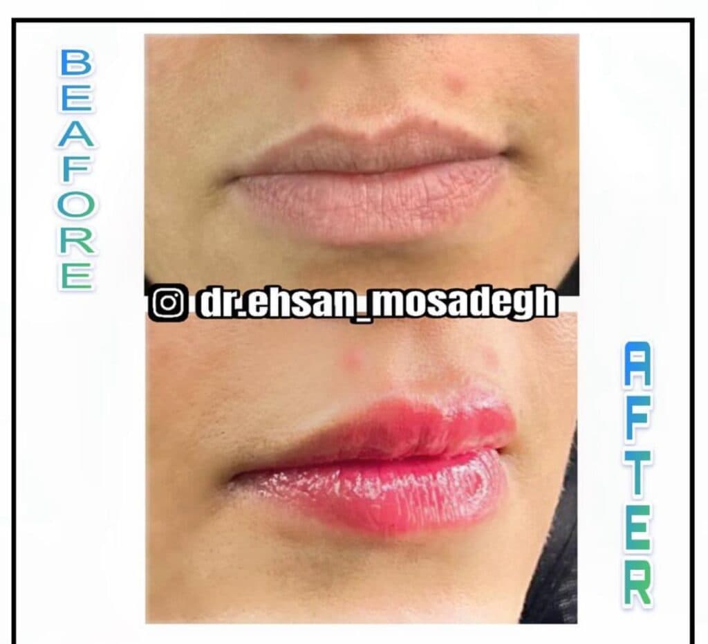 مرکز لیزر و کلینیک زیبایی هانیسان در یاسوج