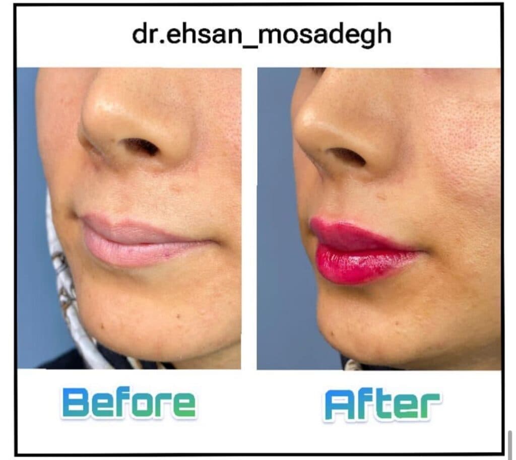 مرکز لیزر و کلینیک زیبایی هانیسان در یاسوج