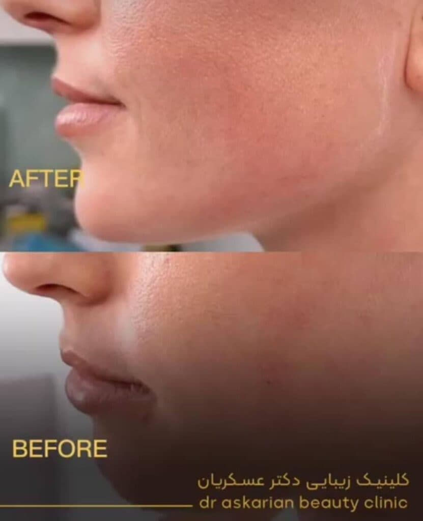 کلینیک زیبایی پوست مو و لیزر دکتر امین عسکریان در شیراز