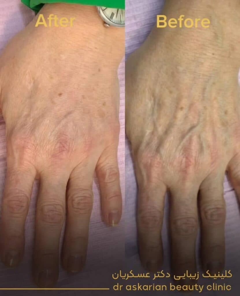 کلینیک زیبایی پوست مو و لیزر دکتر امین عسکریان در شیراز