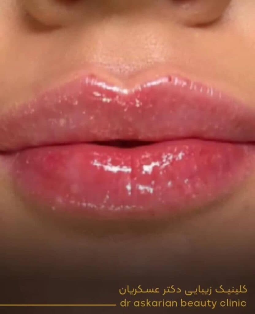 کلینیک زیبایی پوست مو و لیزر دکتر امین عسکریان در شیراز