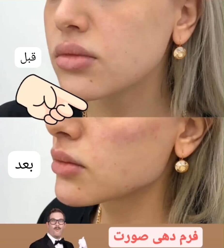 کلینیک تخصصی زیبایی فیلر بادی و زاویه سازی صورت بنیتا در شرق تهران