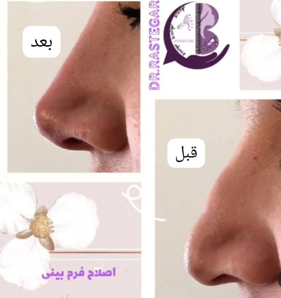 کلینیک تخصصی زیبایی فیلر بادی و زاویه سازی صورت بنیتا در شرق تهران