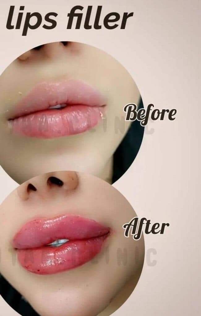 کلینیک تخصصی زیبایی فیلر بادی و زاویه سازی صورت بنیتا در شرق تهران