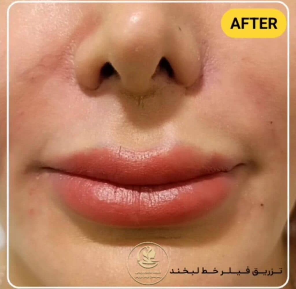 کلینیک تخصصی زیبایی پوست مو و لیزر بیمارستان عرفان نیایش در تهران