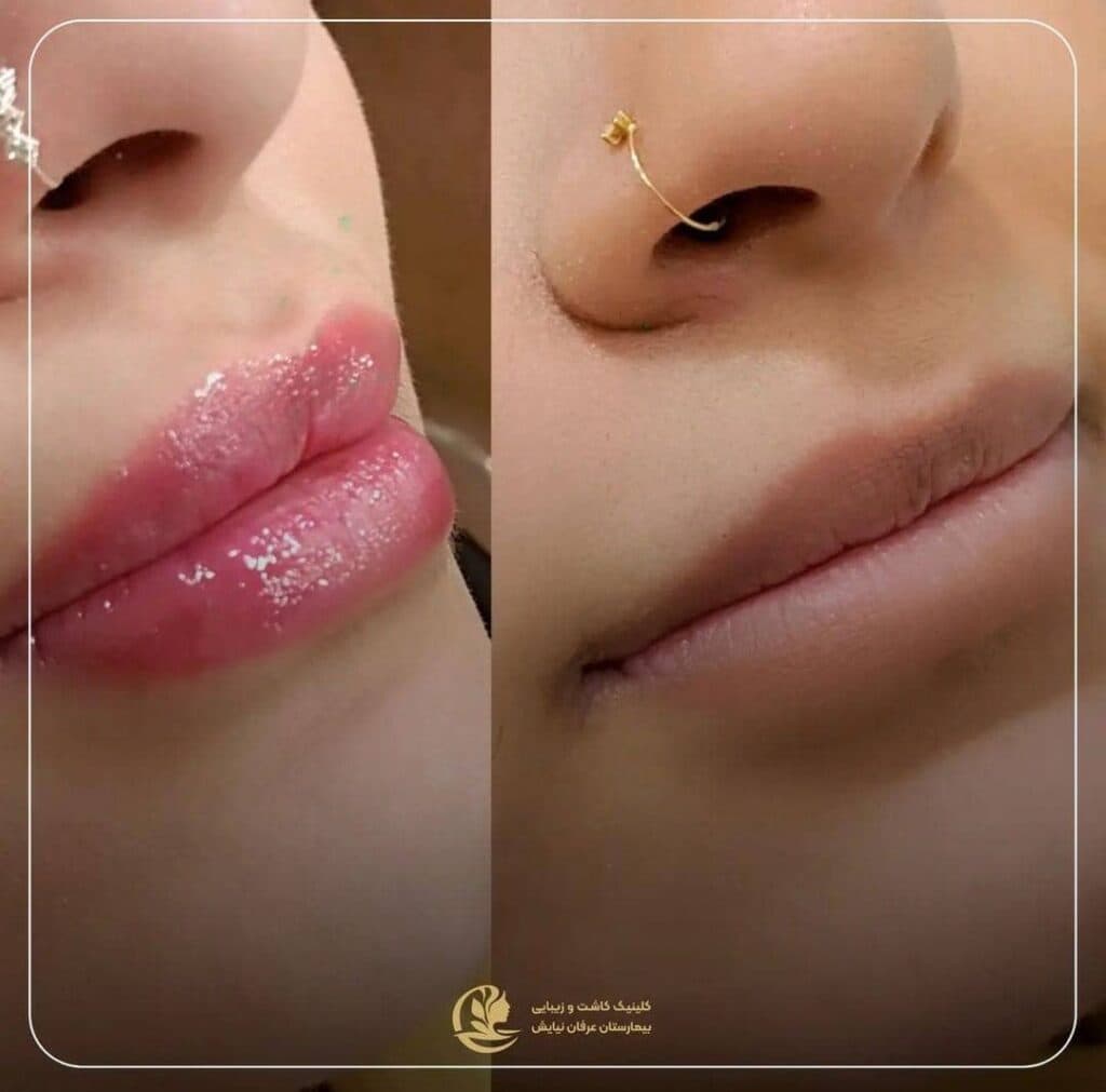 کلینیک تخصصی زیبایی پوست مو و لیزر بیمارستان عرفان نیایش در تهران