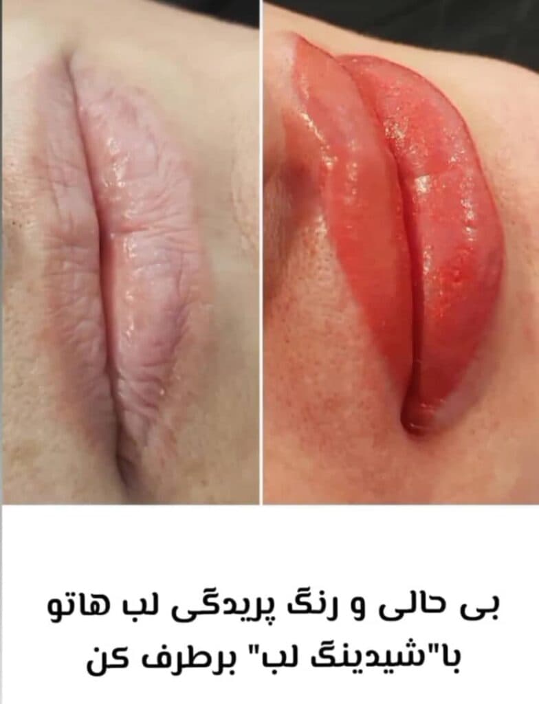 کلینیک تخصصی زیبایی پوست مو و لیزر بیمارستان عرفان نیایش در تهران