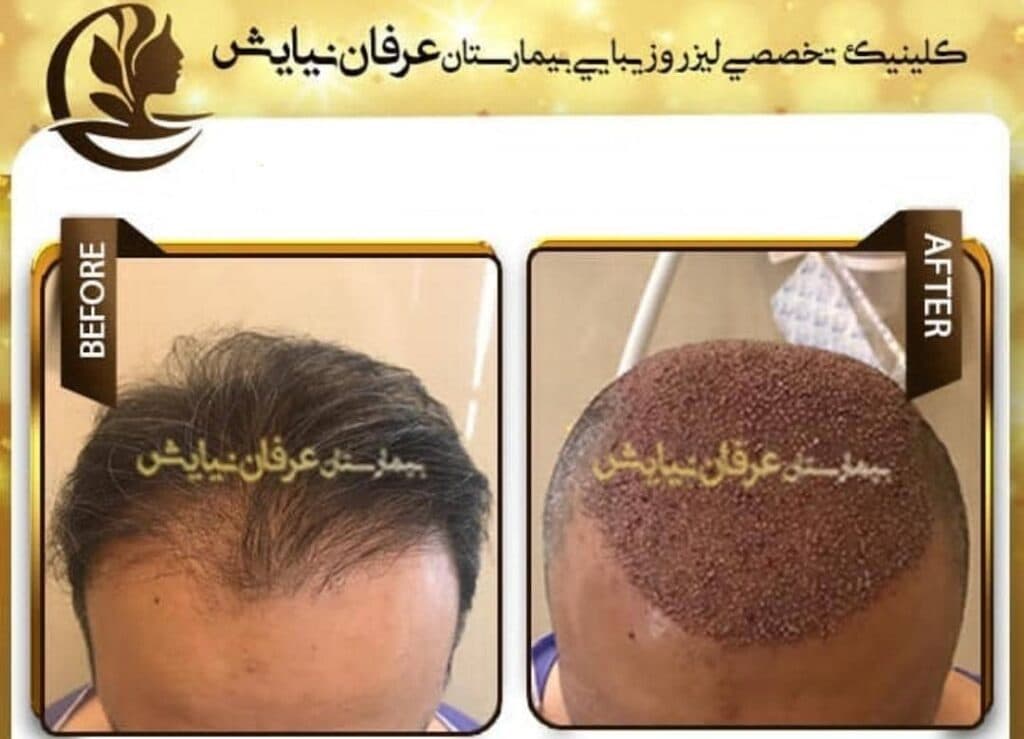 کلینیک تخصصی زیبایی پوست مو و لیزر بیمارستان عرفان نیایش در تهران