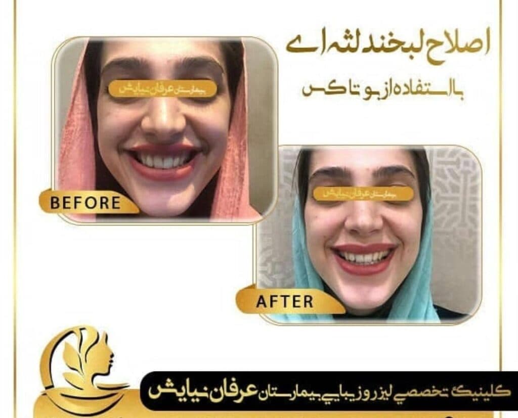 کلینیک تخصصی زیبایی پوست مو و لیزر بیمارستان عرفان نیایش در تهران