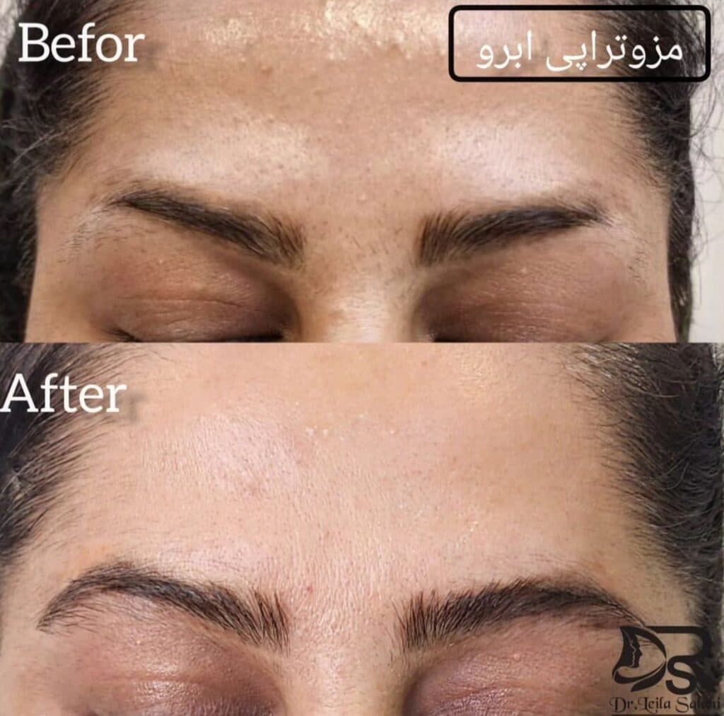 پزشک زیبایی پوست و مو دکتر لیلا صلاحی در همدان