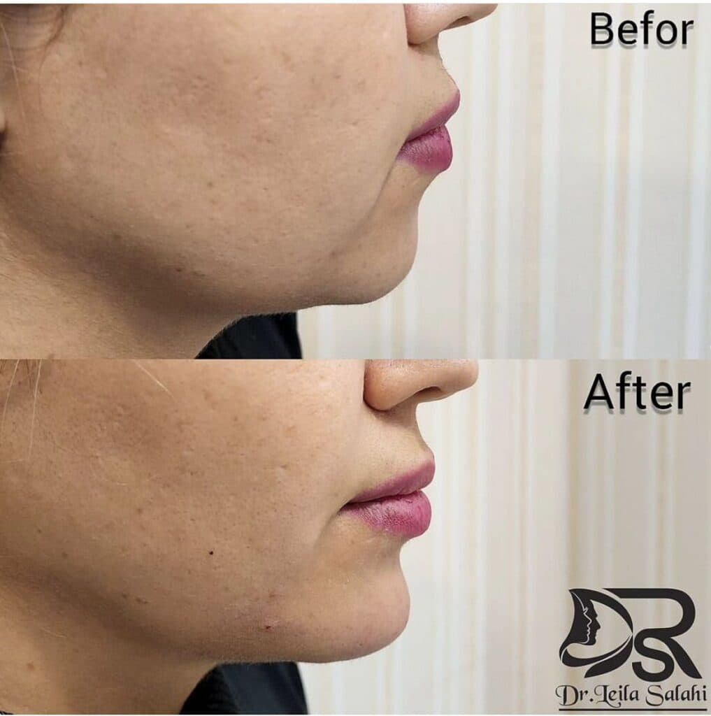 پزشک زیبایی پوست و مو دکتر لیلا صلاحی در همدان