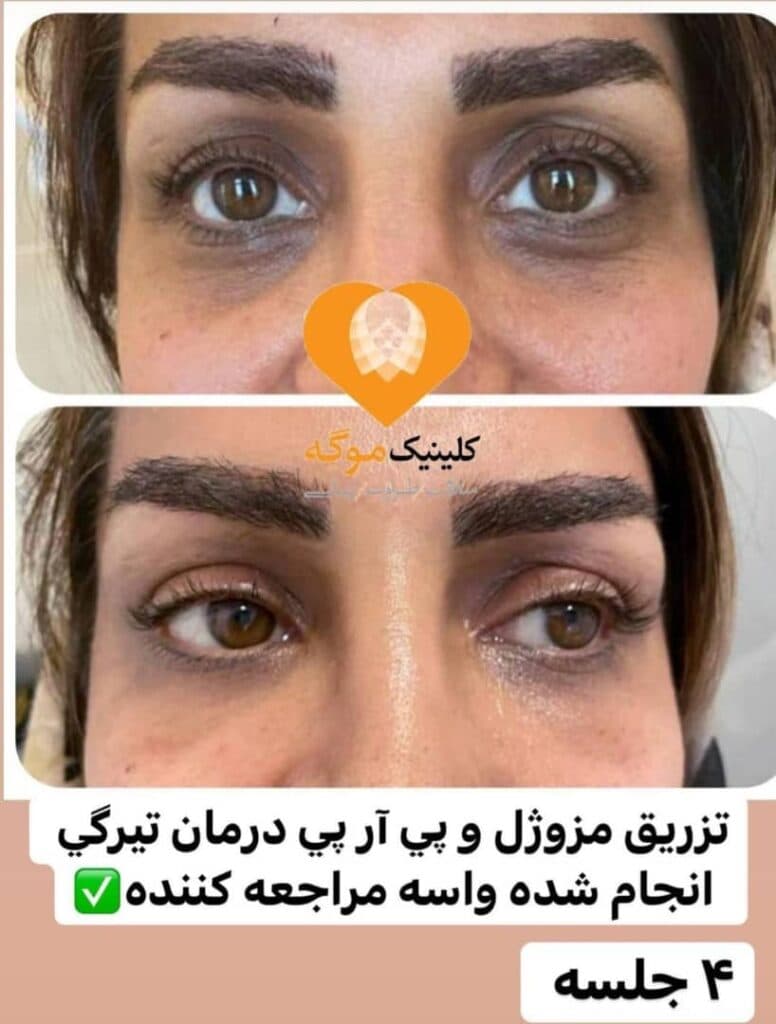 کلینیک زیبایی بوتاکس لیزر آقایان و بانوان موگه در آمل