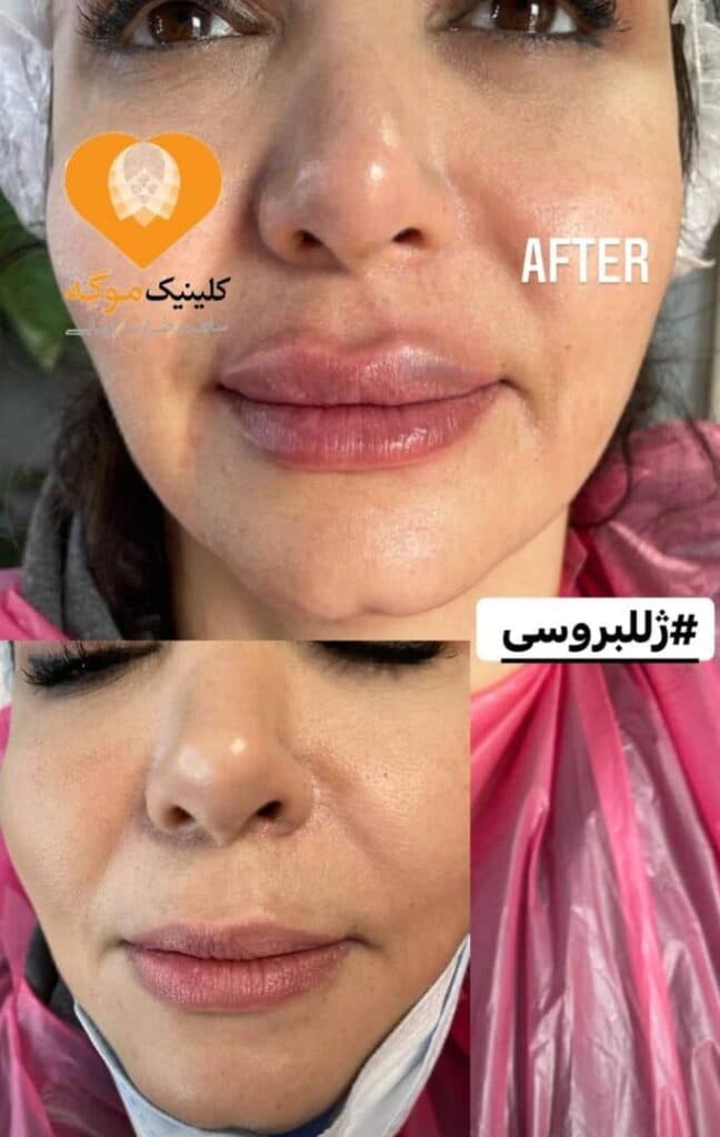 کلینیک زیبایی بوتاکس لیزر آقایان و بانوان موگه در آمل