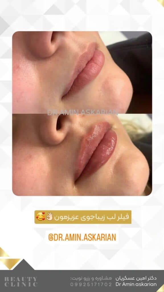 کلینیک زیبایی پوست مو و لیزر دکتر امین عسکریان در شیراز