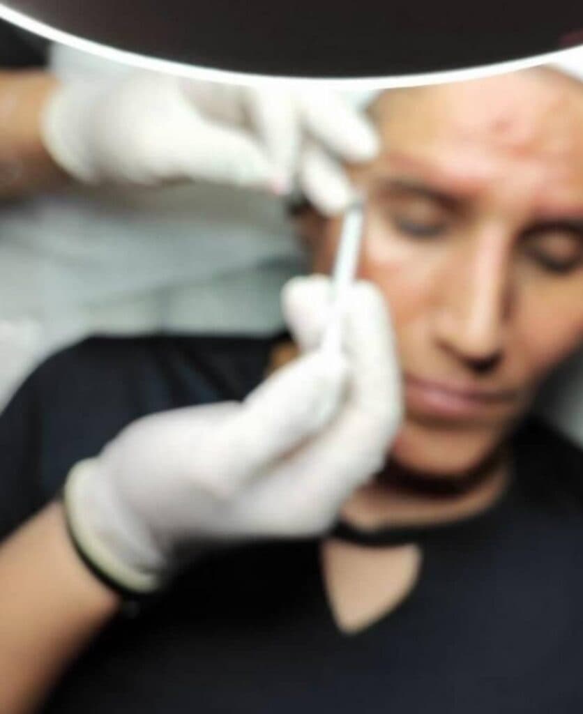 آموزش و خدمات تخصصی لیزر مزوتراپی ژل و بوتاکس آکو در اندیمشک خوزستان