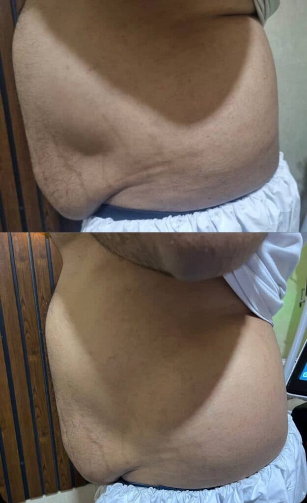 کلینیک تخصصی لاغری و پیکر تراشی body house در چابهار